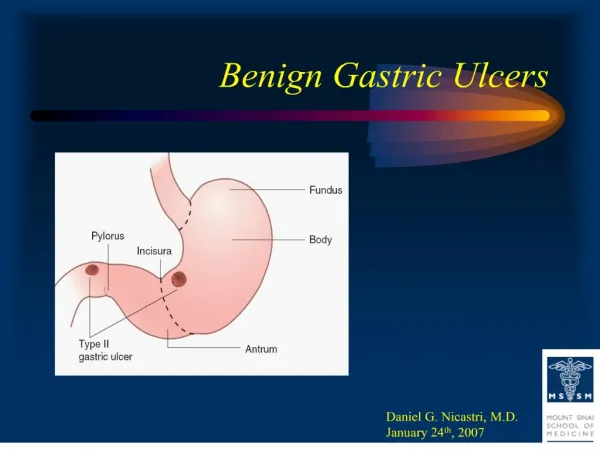 Benign Gastric Ulcers