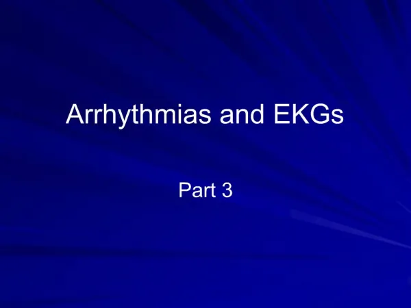 Arrhythmias and EKGs