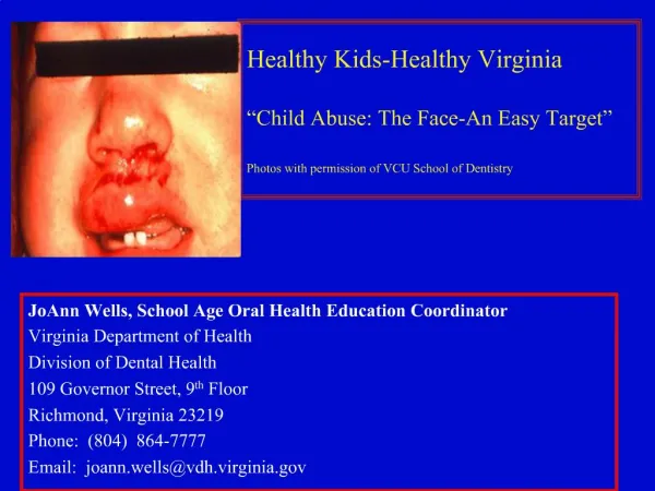 Healthy Kids-Healthy Virginia Child Abuse: The Face-An Easy Target Photos with permission of VCU School of Dentistry