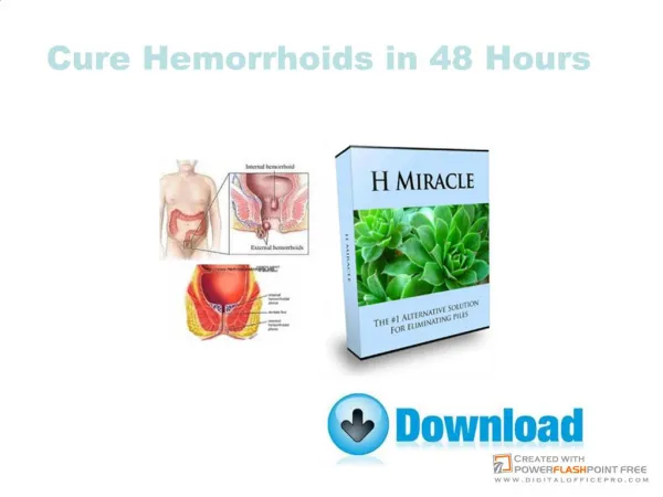 Cure Hemorrhoids in 48 Hours
