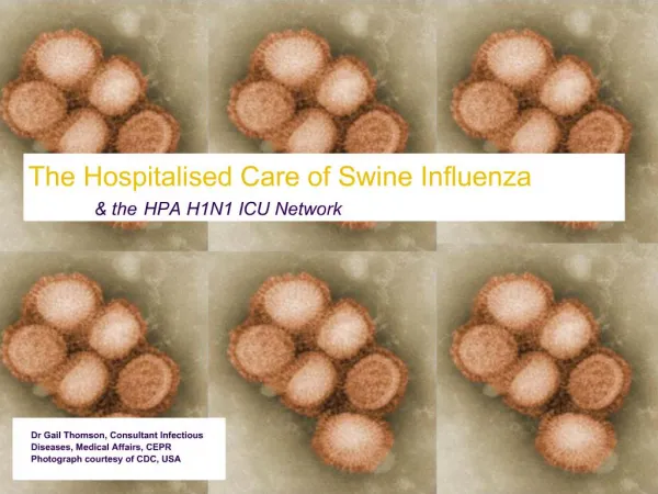 The Hospitalised Care of Swine Influenza the HPA H1N1 ICU Network
