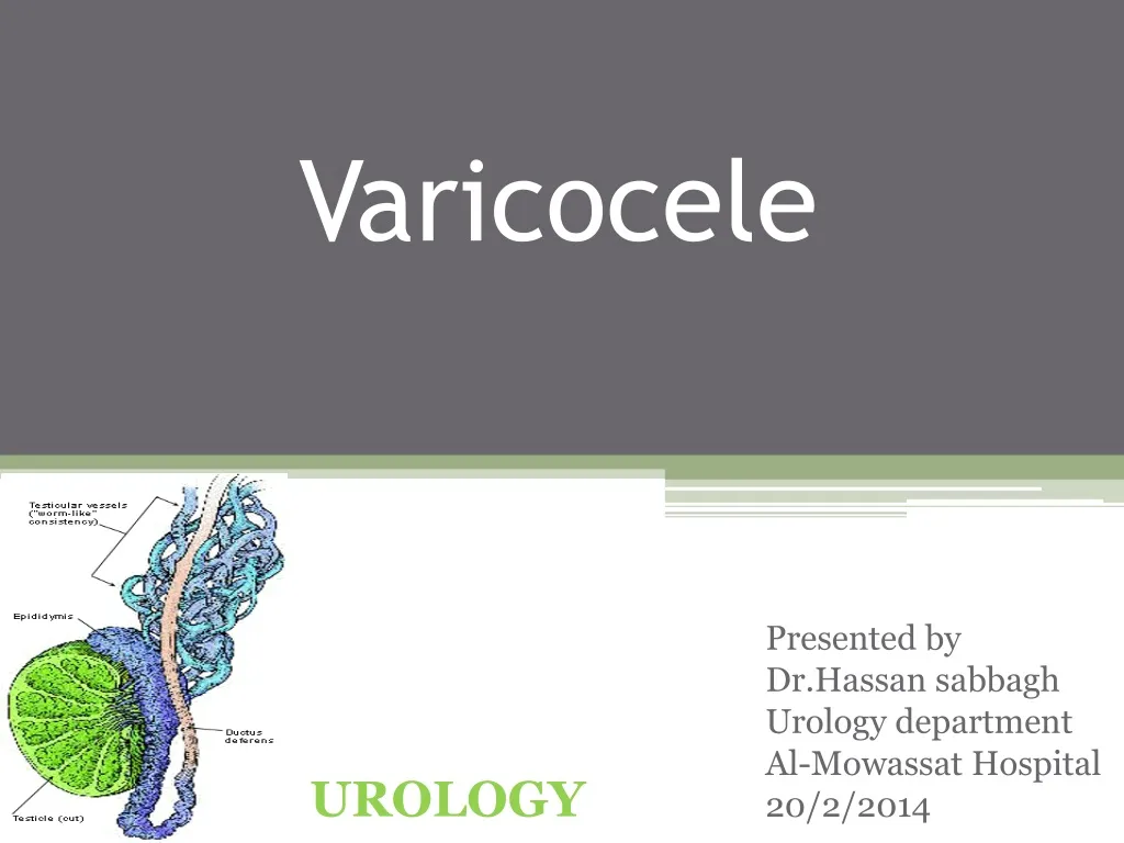 varicocele