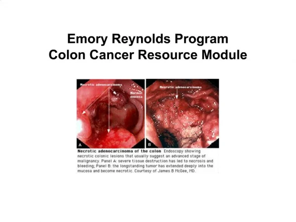 Emory Reynolds Program Colon Cancer Resource Module