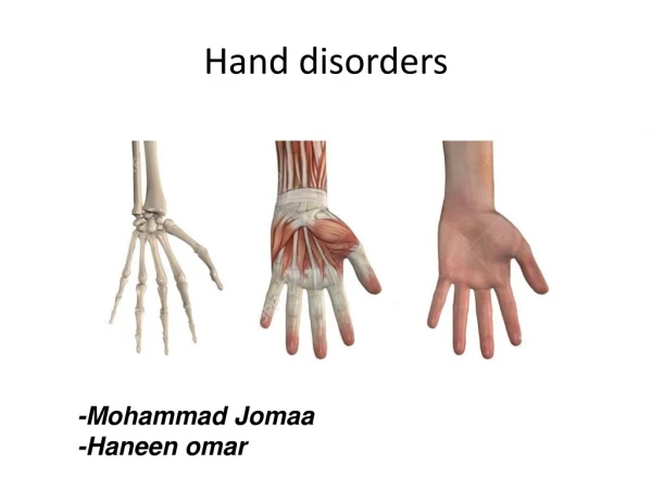 Hand disorders