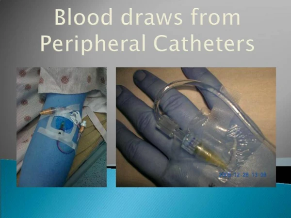 Blood draws from Peripheral Catheters