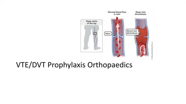 VTE/DVT Prophylaxis Orthopaedics