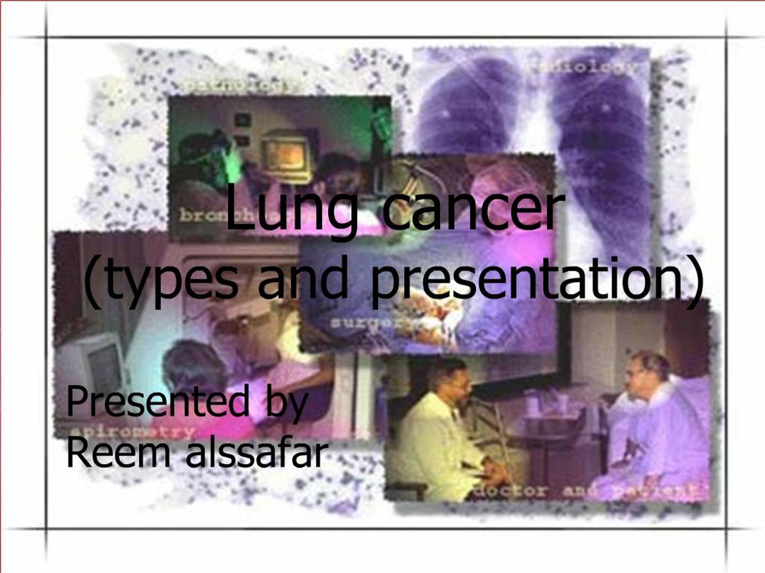 PPT - Lung cancer types and presentation PowerPoint Presentation, free ...