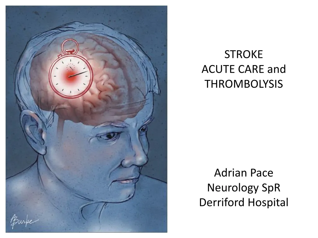 stroke acute care and thrombolysis adrian pace