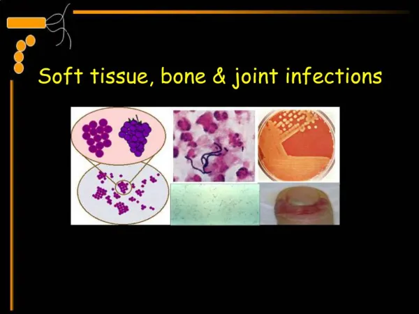 Soft tissue, bone joint infections