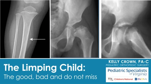 The Limping Child: The good, bad and do not miss