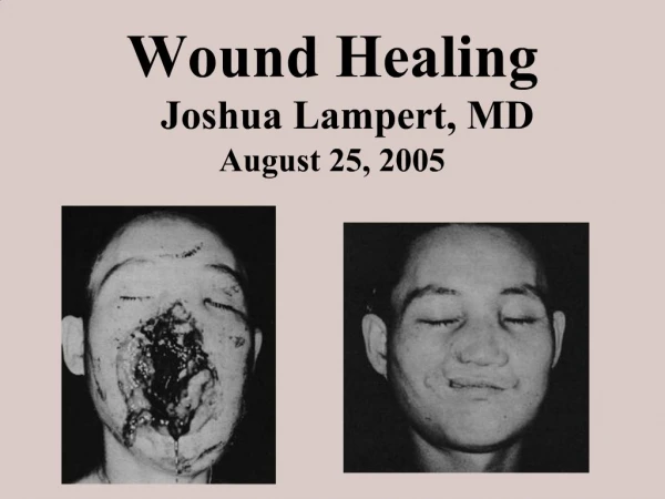 Wound Healing Joshua Lampert, MD August 25, 2005
