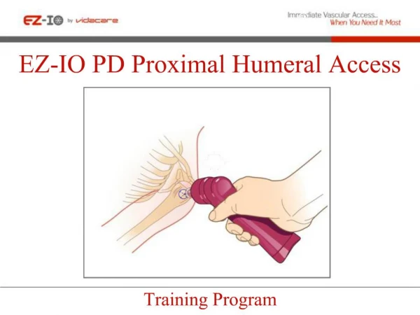 EZ-IO PD Proximal Humeral Access