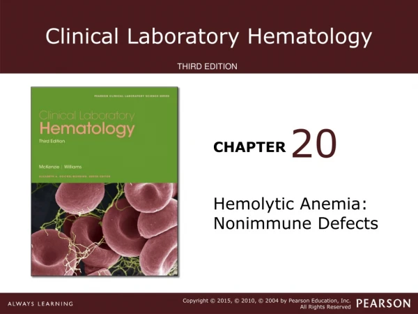 Hemolytic Anemia: Nonimmune Defects