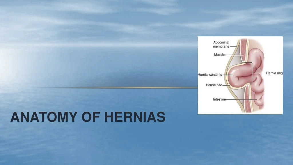 anatomy of hernias