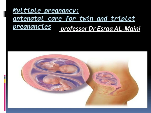 Multiple pregnancy: antenatal care for twin and triplet pregnancies