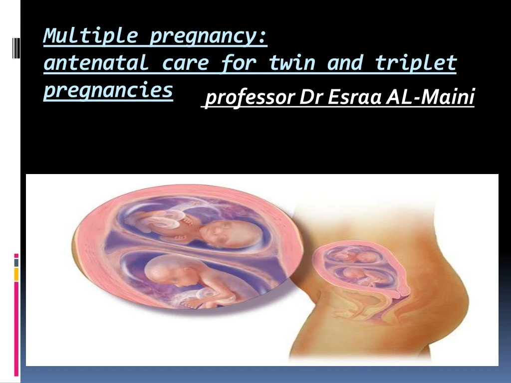 multiple pregnancy antenatal care for twin and triplet pregnancies