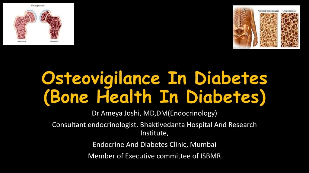 osteovigilance in diabetes bone health in diabetes