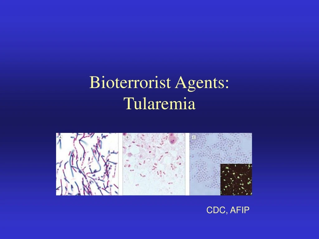 bioterrorist agents tularemia