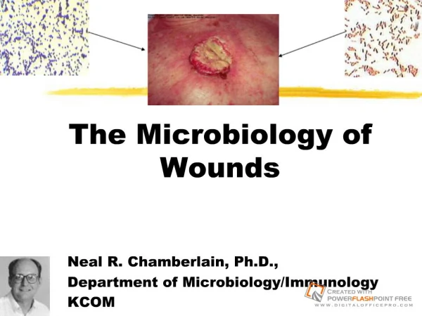 The Microbiology of Wounds