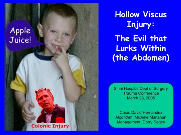 Hollow Viscus Injury: The Evil that Lurks Within the Abdomen