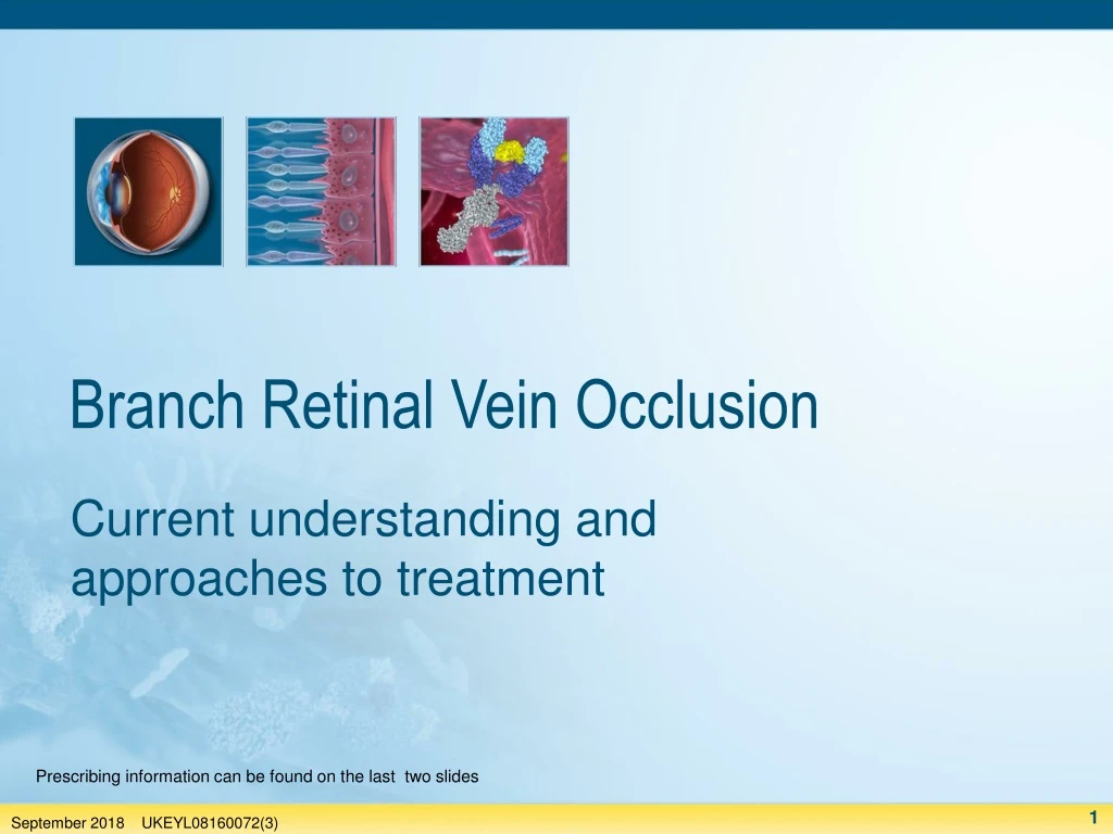 branch retinal vein occlusion
