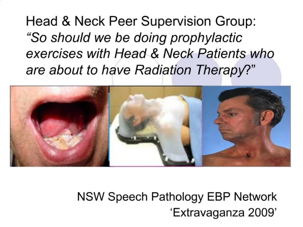 Head Neck Peer Supervision Group: So should we be doing prophylactic exercises with Head Neck Patients who