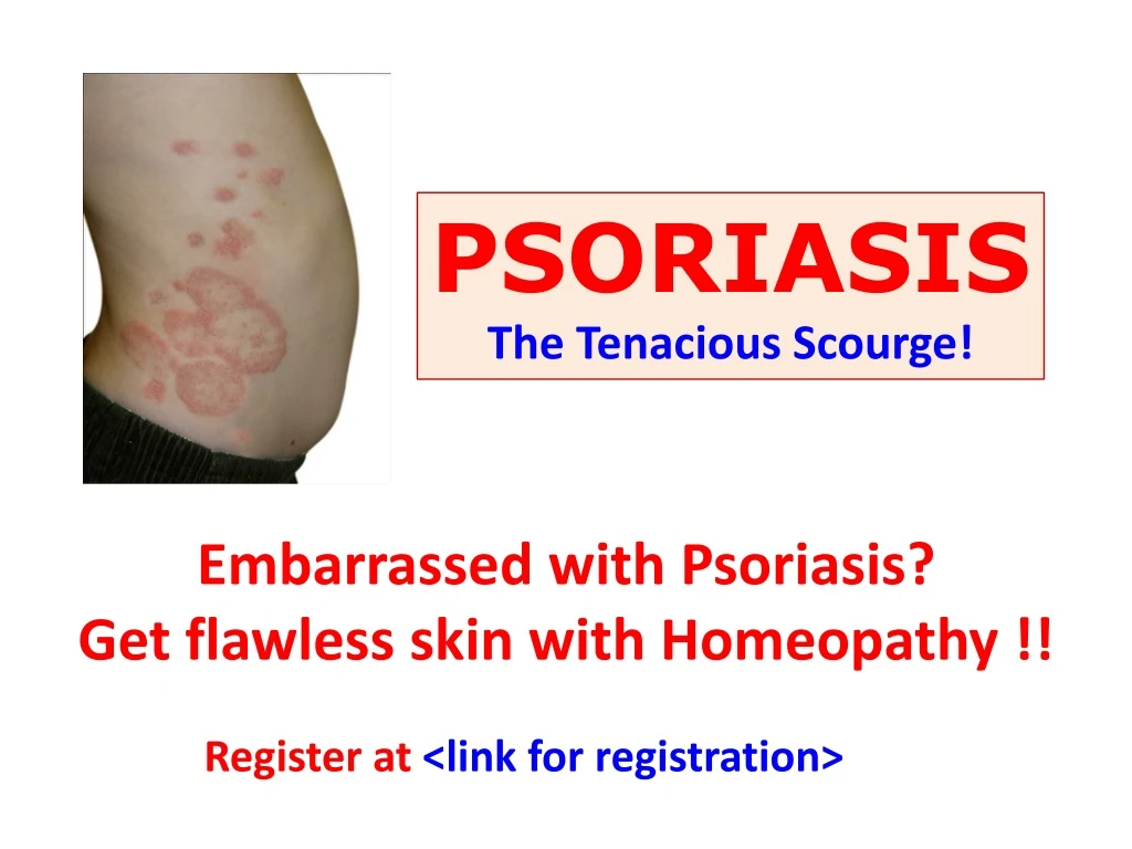 embarrassed with psoriasis get flawless skin with homeopathy