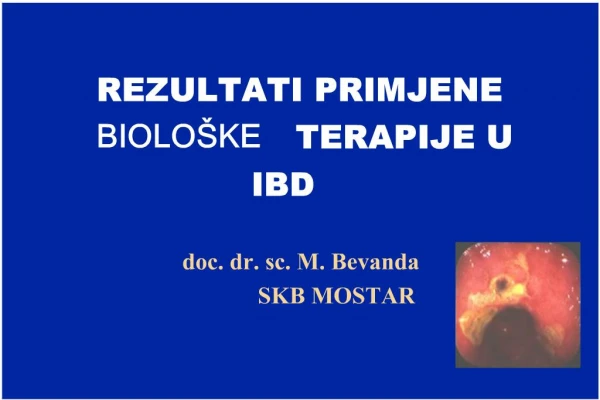 REZULTATI PRIMJENE BIOLO KE TERAPIJE U IBD doc. dr. sc. M. Bevanda SKB MOSTAR