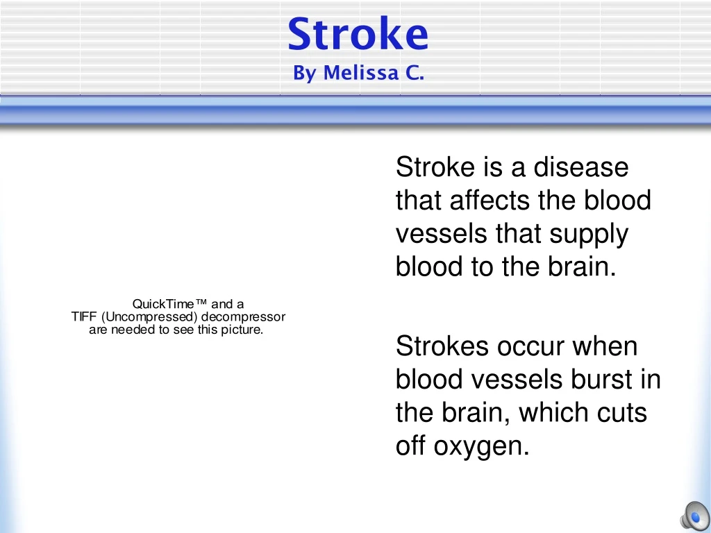 stroke by melissa c