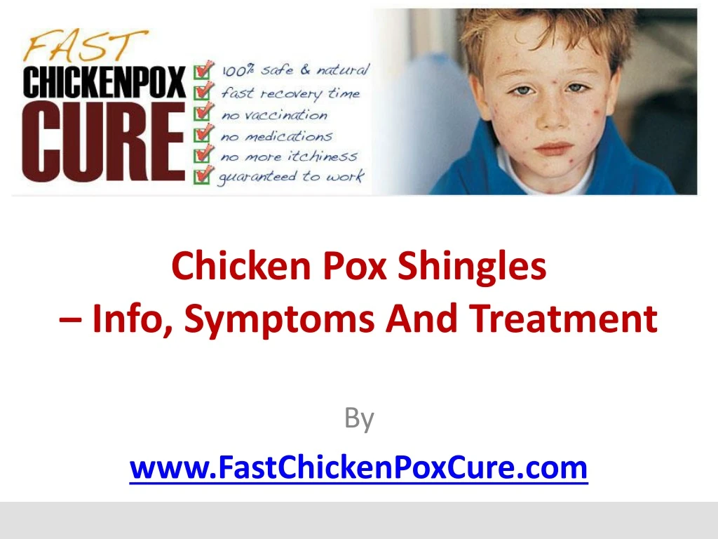chicken pox shingles info symptoms and treatment