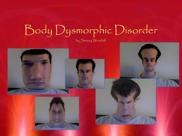 Body Dysmorphic Disorder by Stacey Westfall