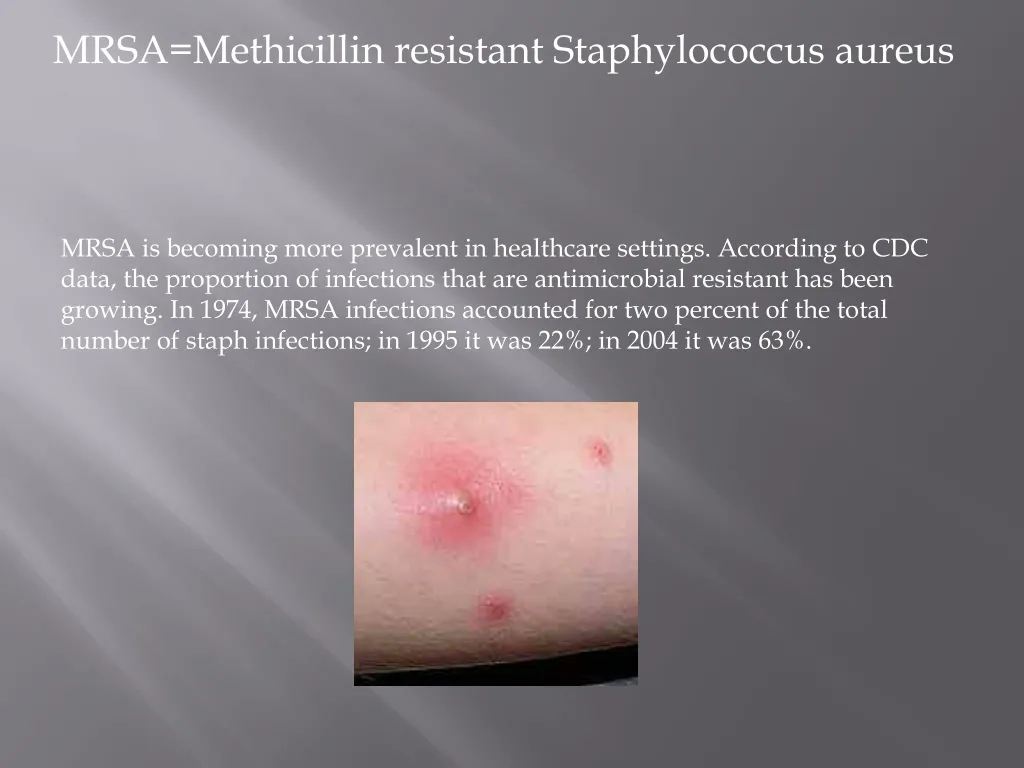 mrsa methicillin resistant staphylococcus aureus