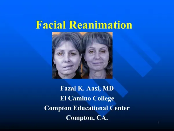Facial Reanimation