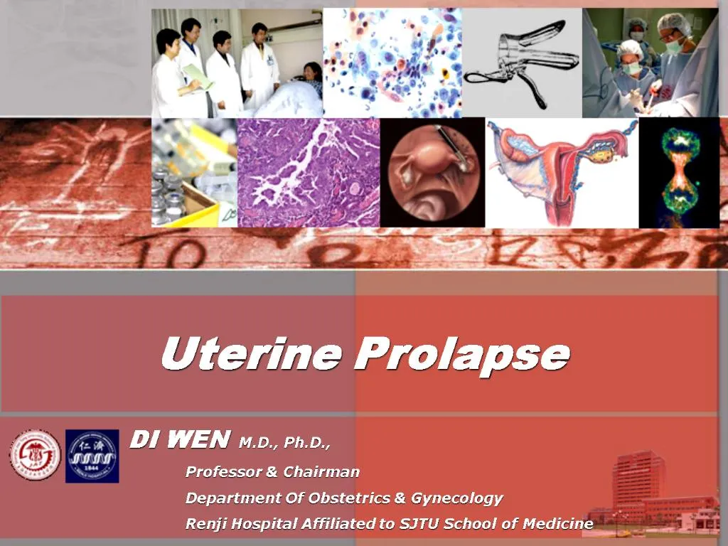 PPT - Uterine Prolapse PowerPoint Presentation, free download - ID:483273