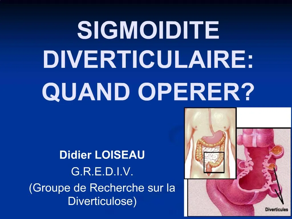 PPT - SIGMOIDITE DIVERTICULAIRE: QUAND OPERER? PowerPoint ...