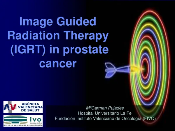 Image Guided Radiation Therapy (IGRT) in prostate cancer