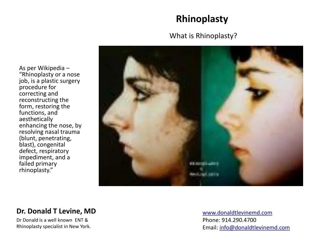as per wikipedia rhinoplasty or a nose