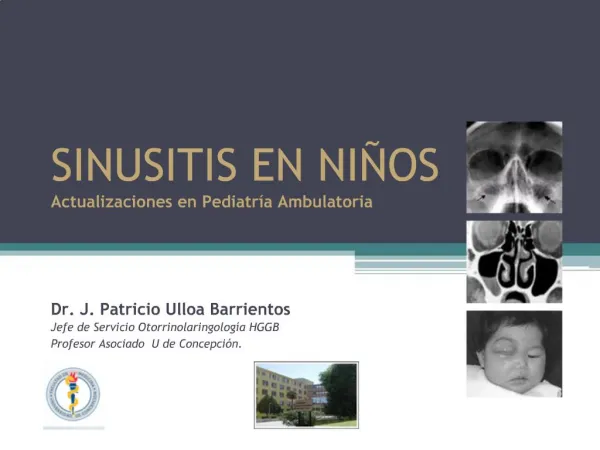 SINUSITIS EN NI OS Actualizaciones en Pediatr a Ambulatoria