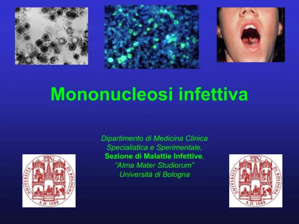 Mononucleosi infettiva