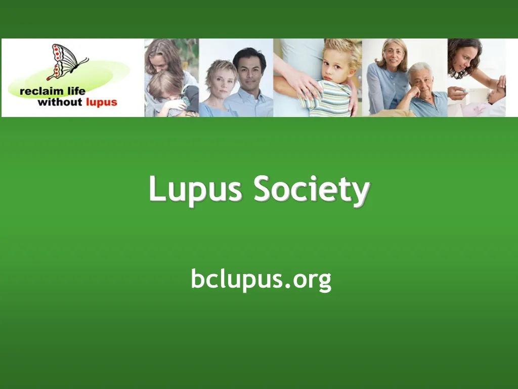 lupus society