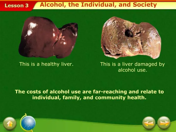 This is a healthy liver.