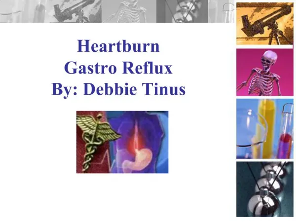 Heartburn Gastro Reflux By: Debbie Tinus