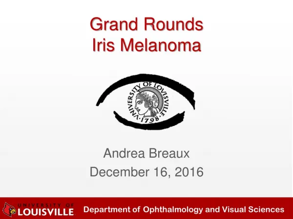 Grand Rounds Iris Melanoma