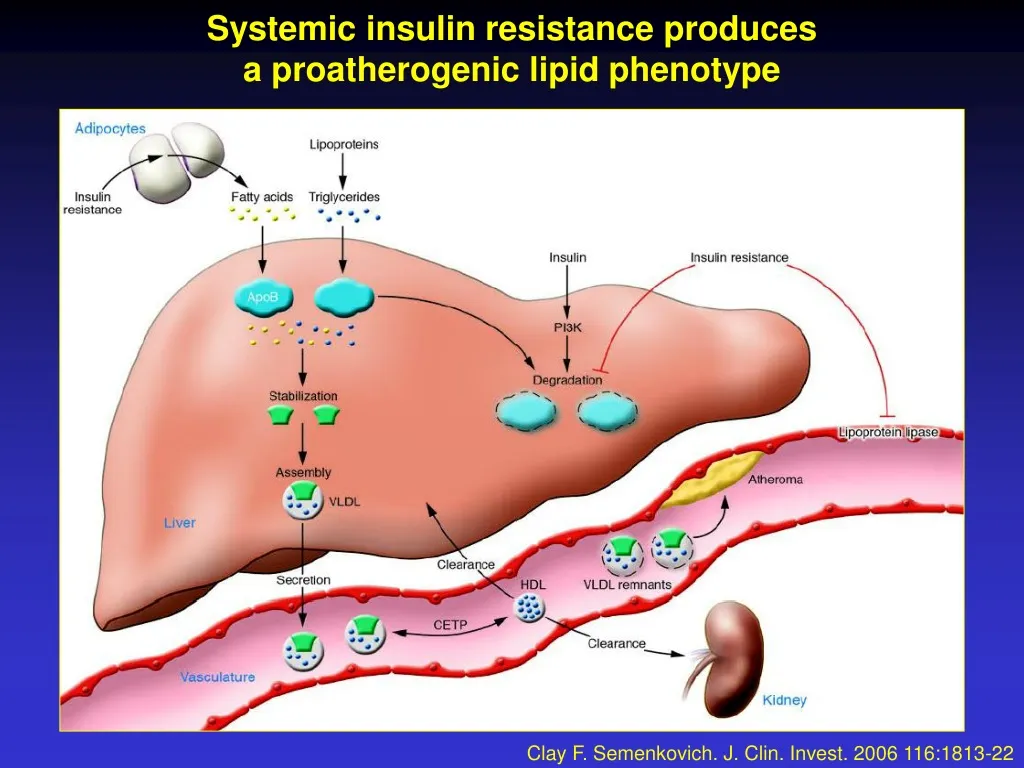 systemic insulin resistance produces