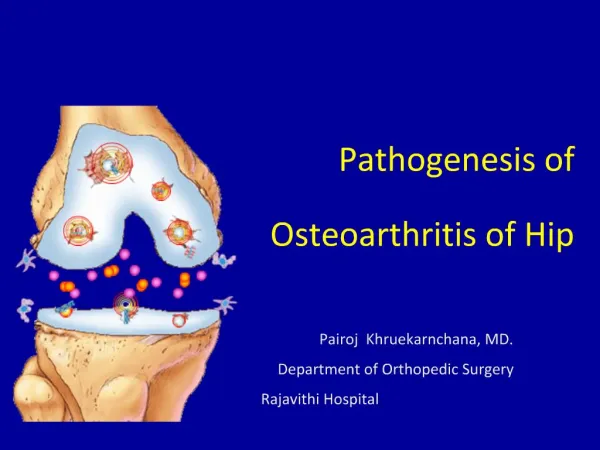 Pathogenesis of Osteoarthritis of Hip