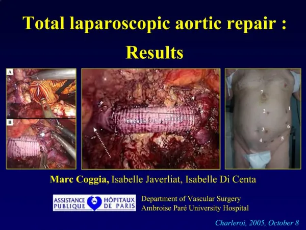 Total laparoscopic aortic repair : Results