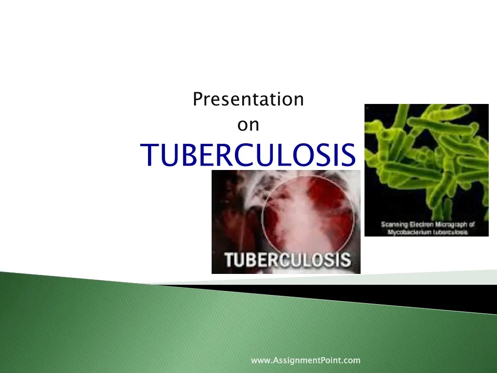 presentation on tuberculosis