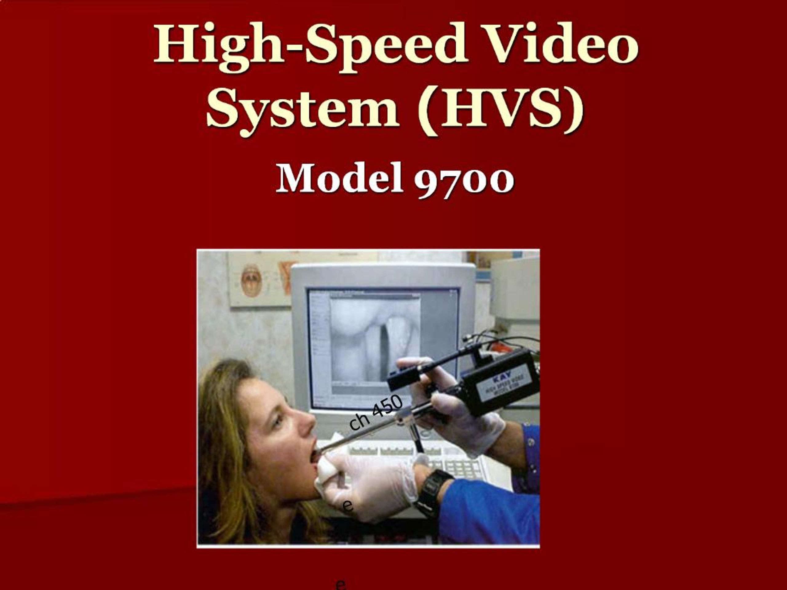 Scan Hvs PPT - High-Speed Video System HVS PowerPoint Presentation, free ...