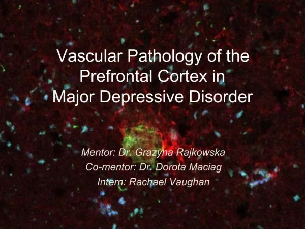 Vascular Pathology of the Prefrontal Cortex in Major Depressive Disorder