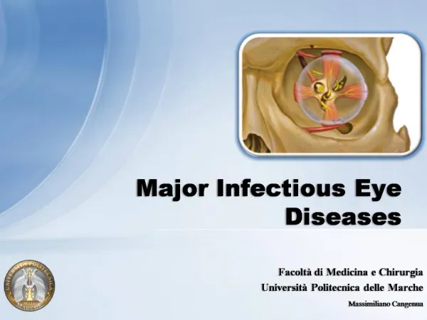 Major Infectious Eye Diseases